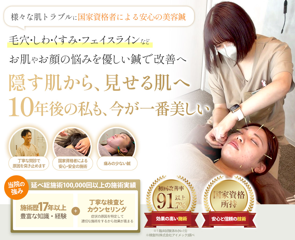 美容鍼