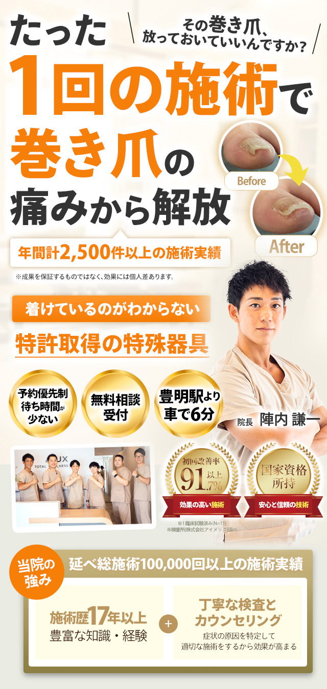 巻き爪施術